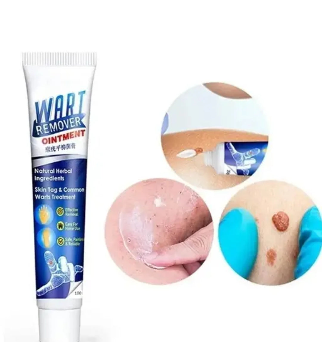 Wart remover painless solution