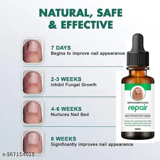 Nail Oil - For Nail Growth |Long,Strong Nail |Repair Break Nail & Cuticle Yellow