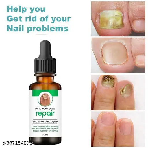Nail Oil - For Nail Growth |Long,Strong Nail |Repair Break Nail & Cuticle Yellow