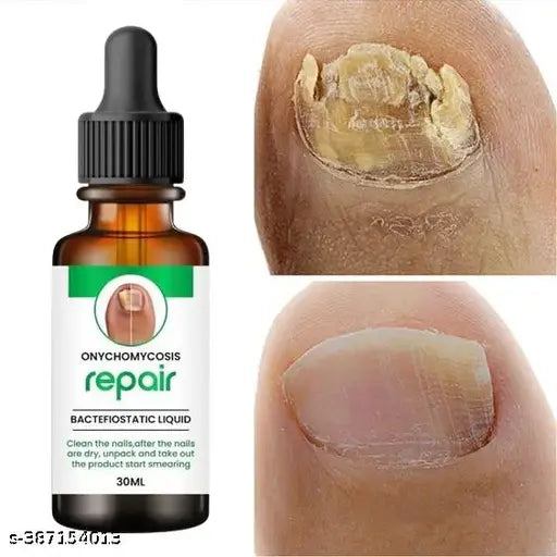 Nail Oil - For Nail Growth |Long,Strong Nail |Repair Break Nail & Cuticle Yellow
